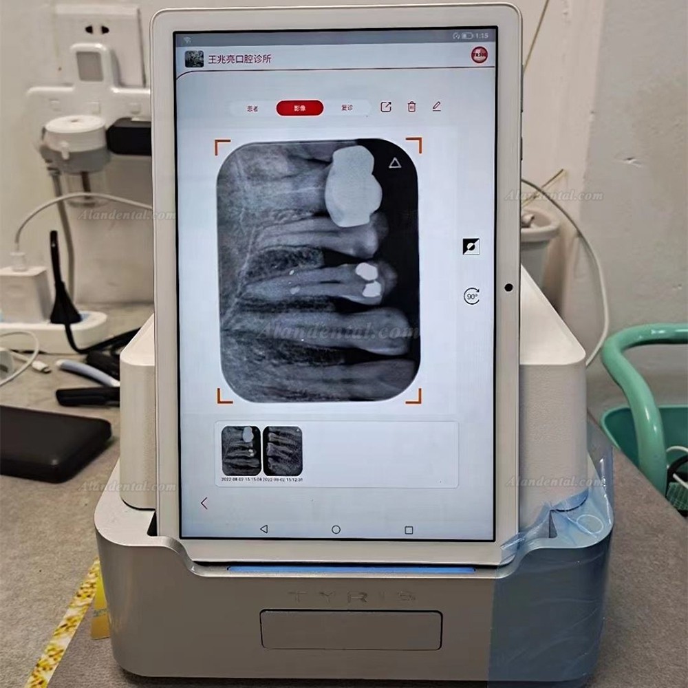 TYRIS TR310 Dental Phosphor Plate Scanner with PAD and Image Plate